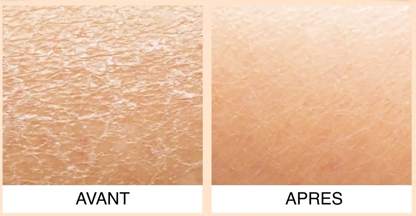 Sylvaskin — Crème Nourrissante Visage & Corps